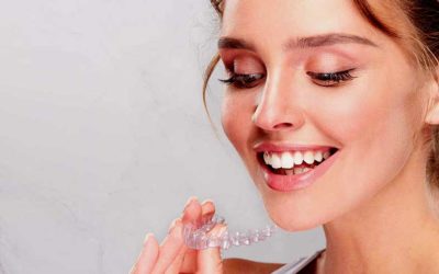 How Invisalign Process Works?