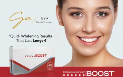 Why Opalescence Teeth Whitening Boost is Unique
