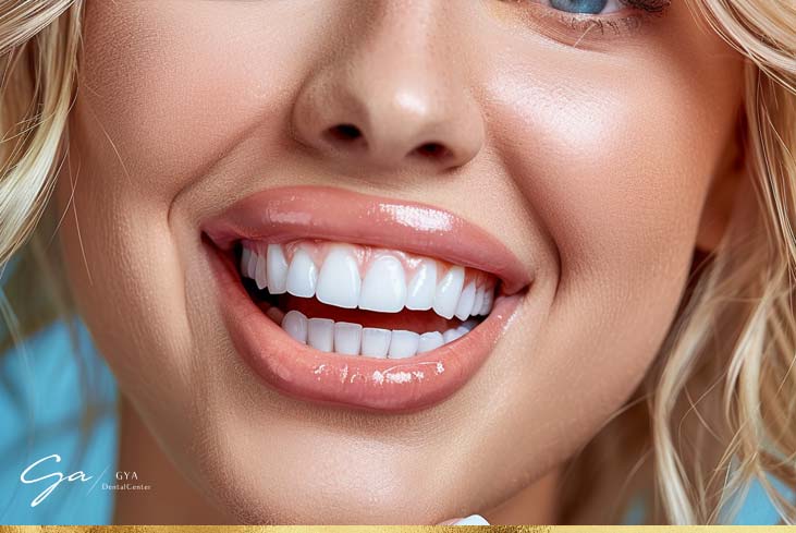 5 Things to Avoid After Whitening your Teeth