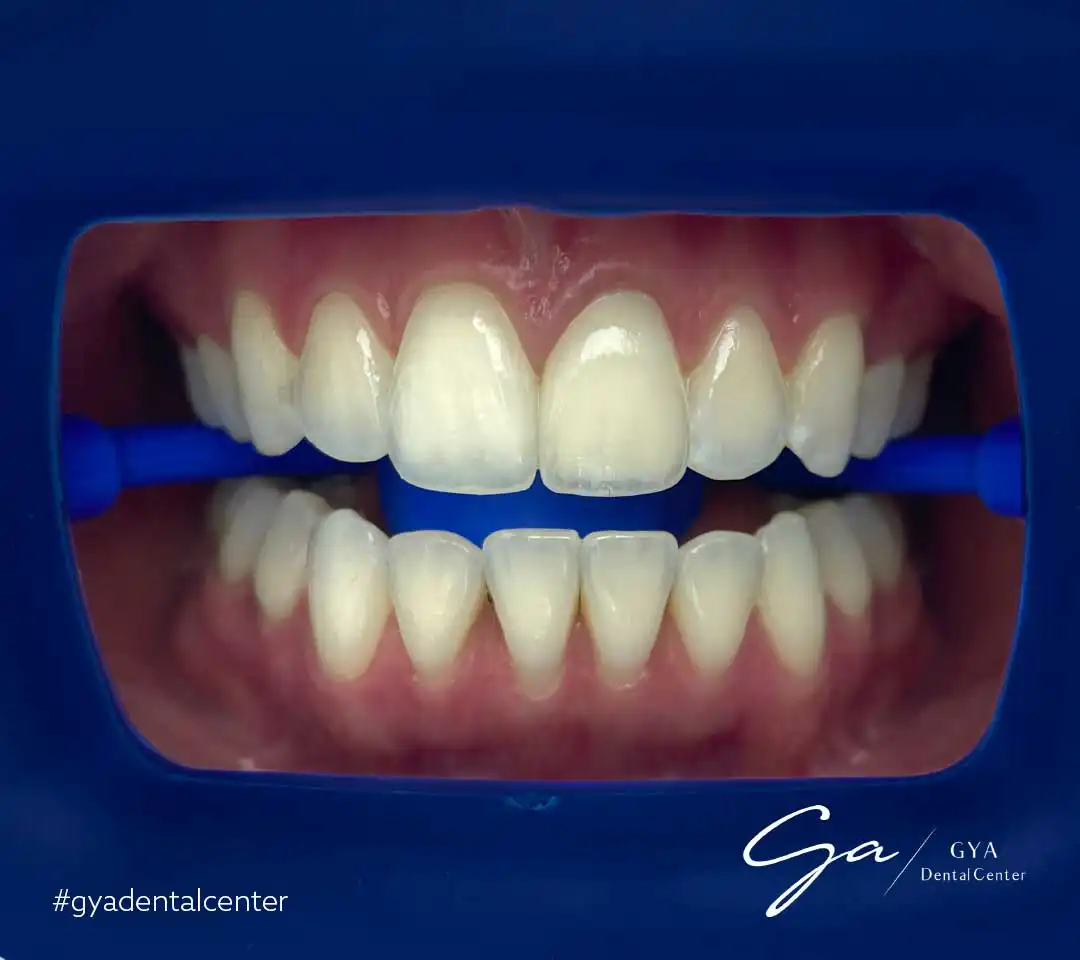 | GYA Dental Center | June, 2024